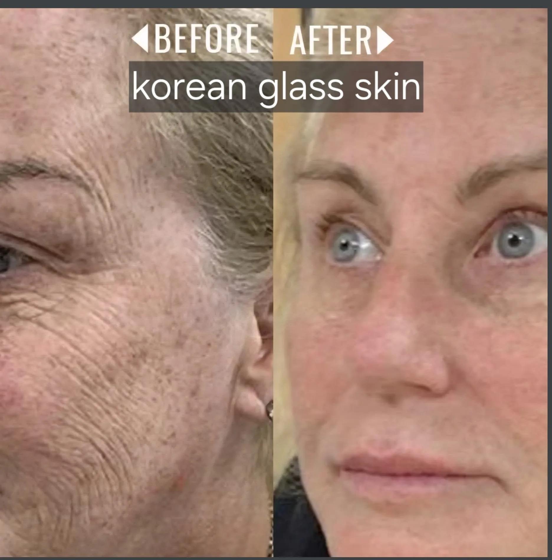 Korean glass skin: voor en na