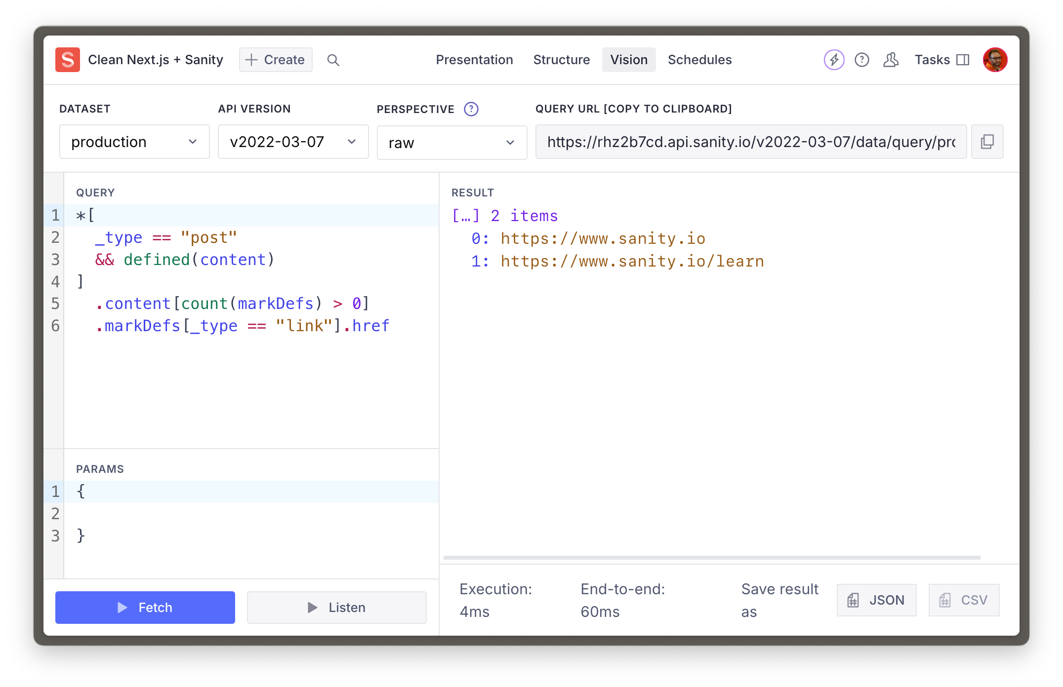 Sanity Studio showing the Vision tool performing a GROQ query