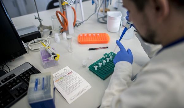 Naučnici su razvili eksperimentalni tretman za borbu protiv raka koji je uništio 99 odsto ćelija kancera u laboratorijskim testovima bez početnog oslanjanja na hemioterapiju, hirurgiju ili zračenje