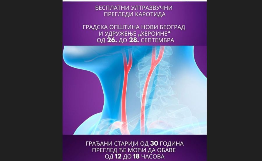 Image for Besplatan pregled karotida