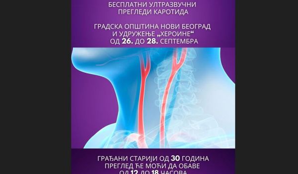Image for Besplatan pregled karotida