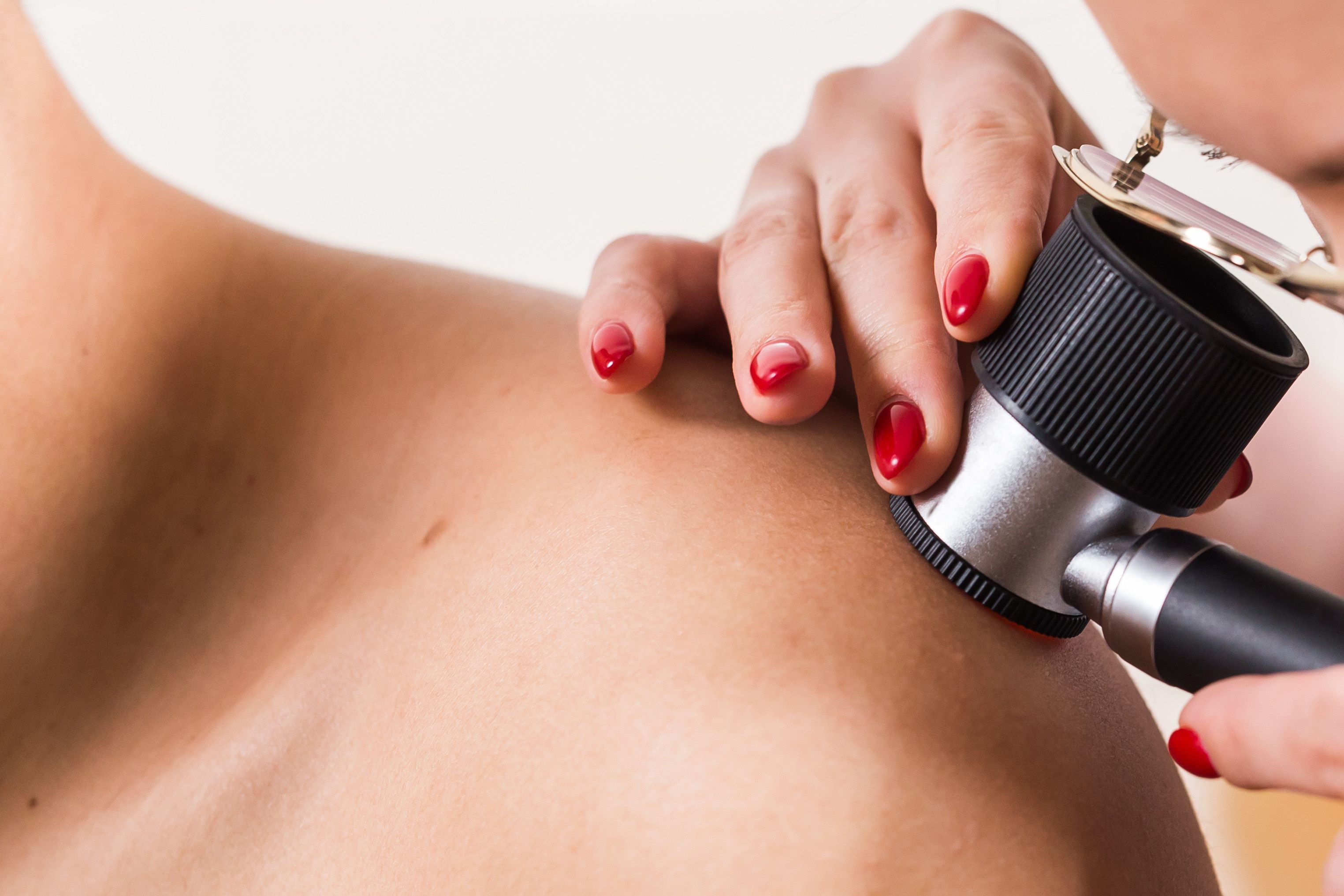 Image for Donirano 10 dermoskopa