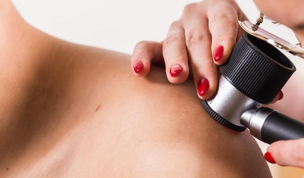 Image for Donirano 10 dermoskopa