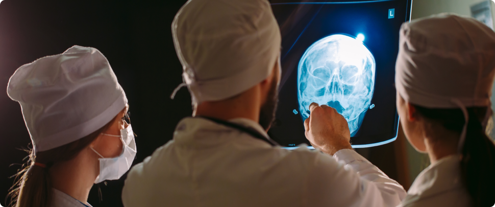 Image for Povrede glave povećavaju rizik nastanka moždanog udara