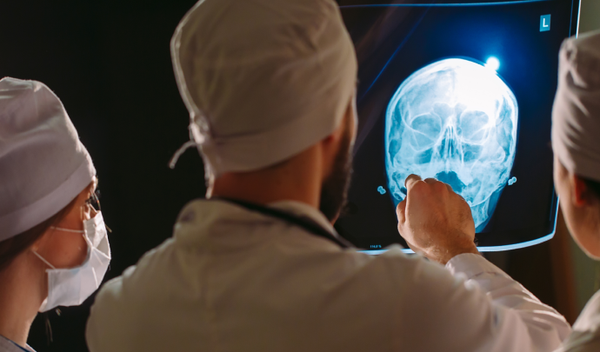 Image for Povrede glave povećavaju rizik nastanka moždanog udara
