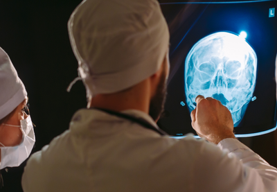 Image for Povrede glave povećavaju rizik nastanka moždanog udara