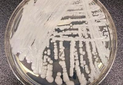 Gljivica "Candida auris", poznata i kao "C. auris", predstavlja vrstu kvasca koji može da izazove teške infekcije kod osoba sa oslabljenim imunitetom