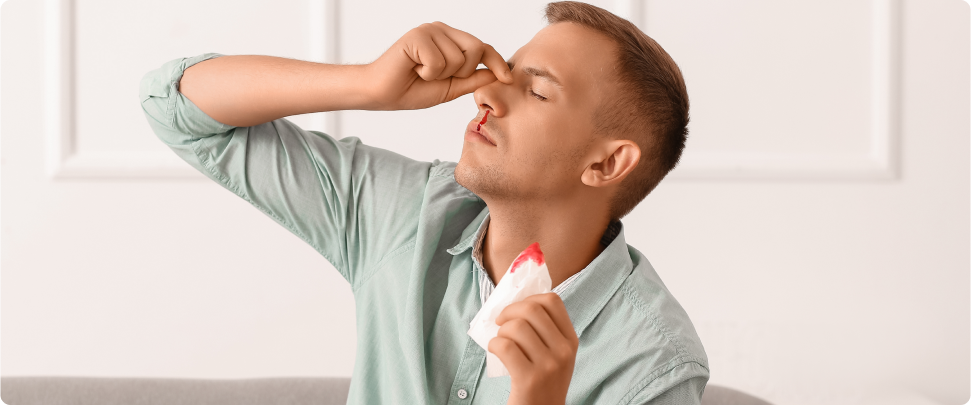 Image for Da li je krvarenje iz nosa opasno?