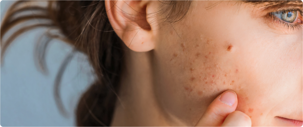 Image for Zbog čega pubertet počinje sve ranije?