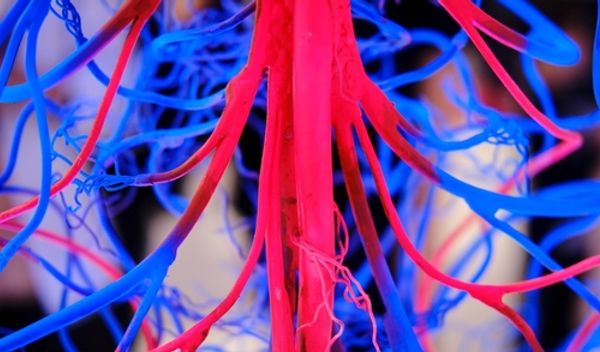 Image for Čuveni hirurg objasnio šta zaista uništava krvne sudove