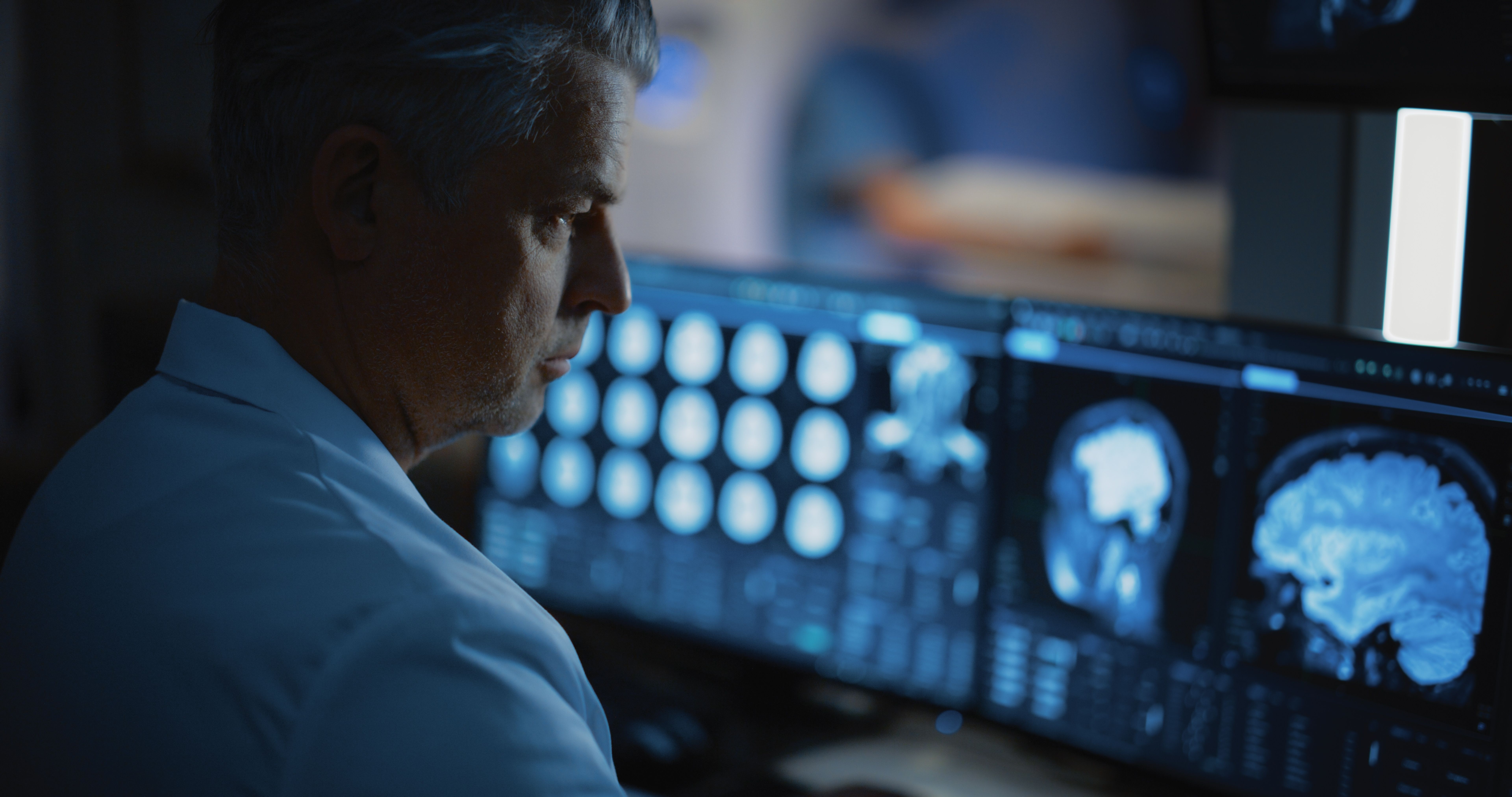 Image for Nova otkrića: multipla skleroza može se otkriti godinama pre prvih simptoma