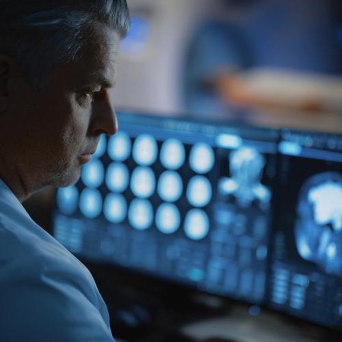 Image for Nova otkrića: multipla skleroza može se otkriti godinama pre prvih simptoma