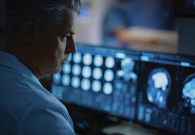 Image for Nova otkrića: multipla skleroza može se otkriti godinama pre prvih simptoma