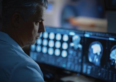 Image for Nova otkrića: multipla skleroza može se otkriti godinama pre prvih simptoma