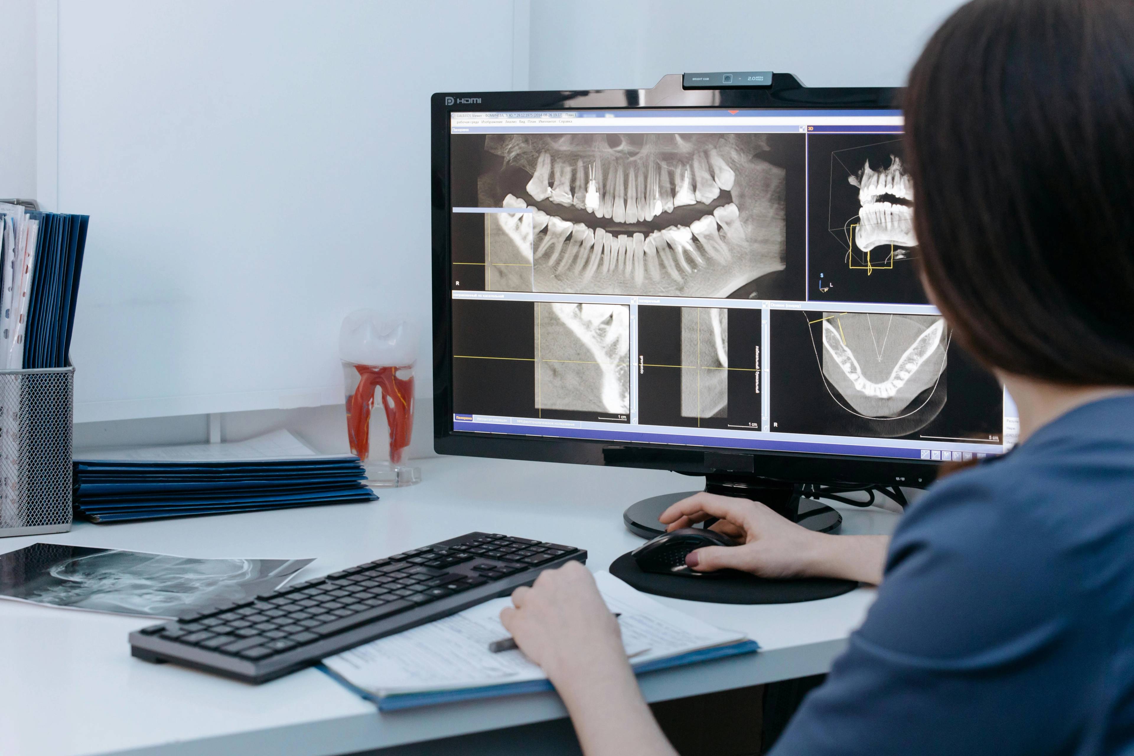 A dentist looking at an x-ray of a patient's teeth on computer screen