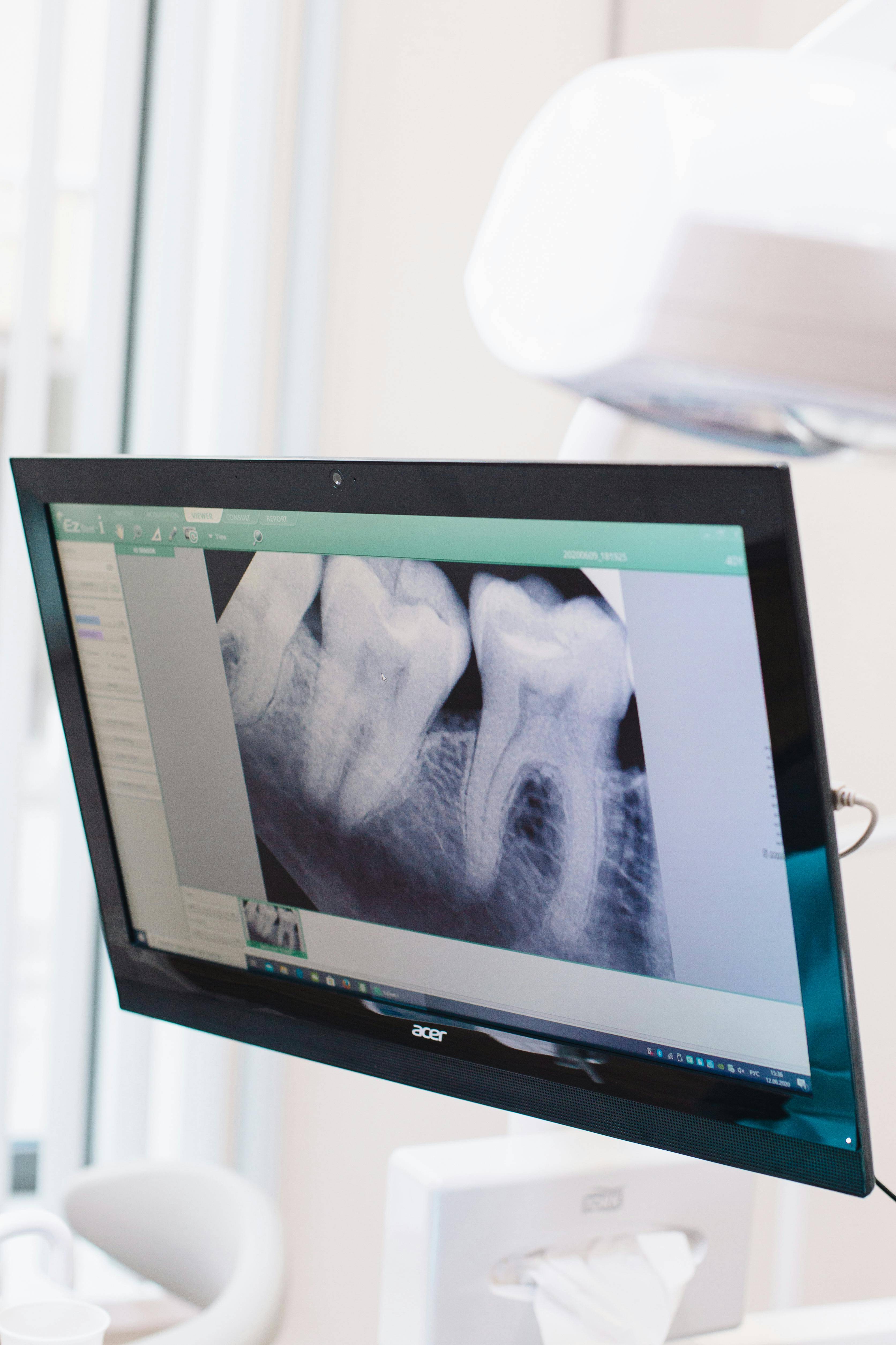 A dentist looks at an x-ray of a patient's teeth