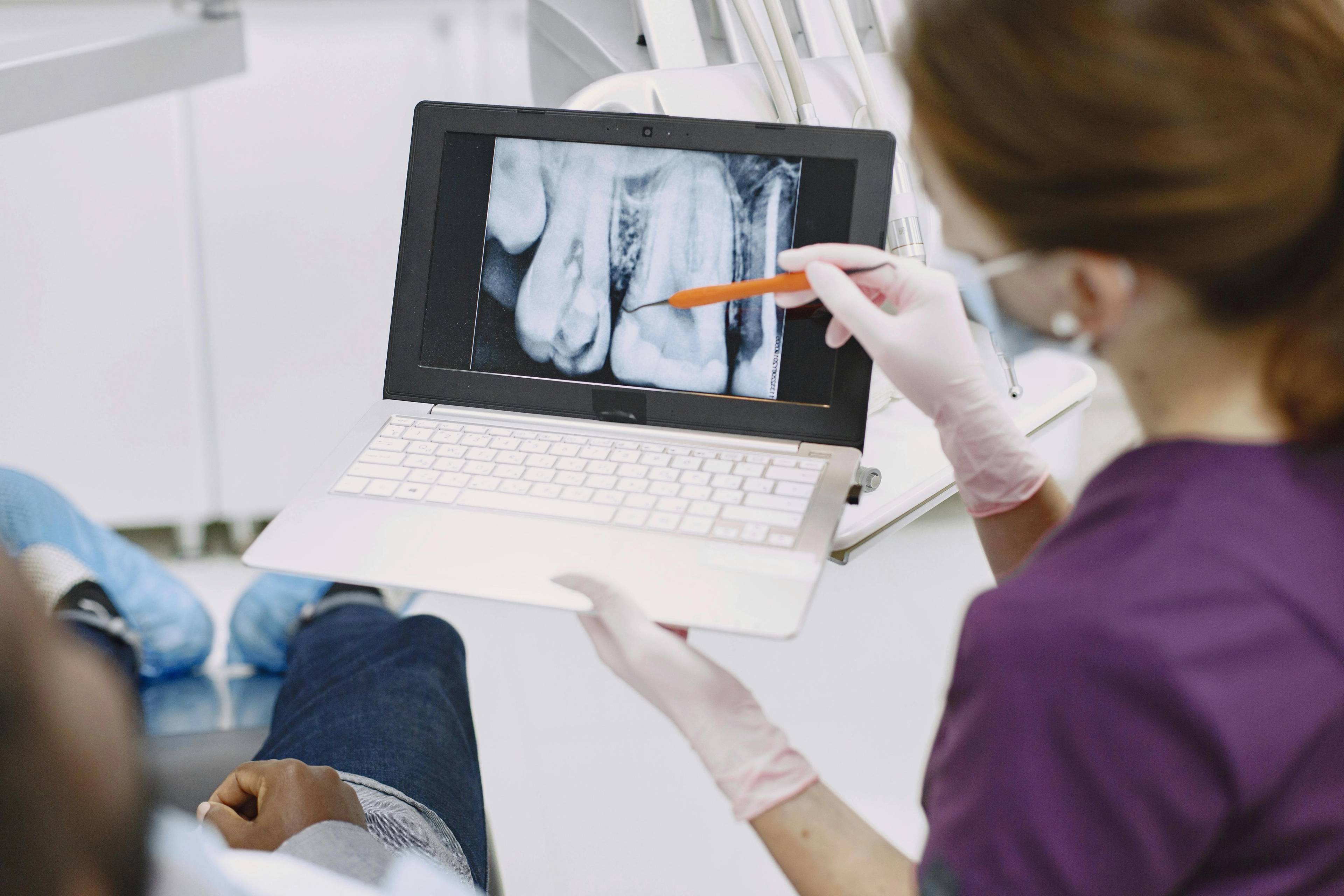 A dentist looks at an x-ray of a patient's teeth on laptop pointing with instrument at the screen