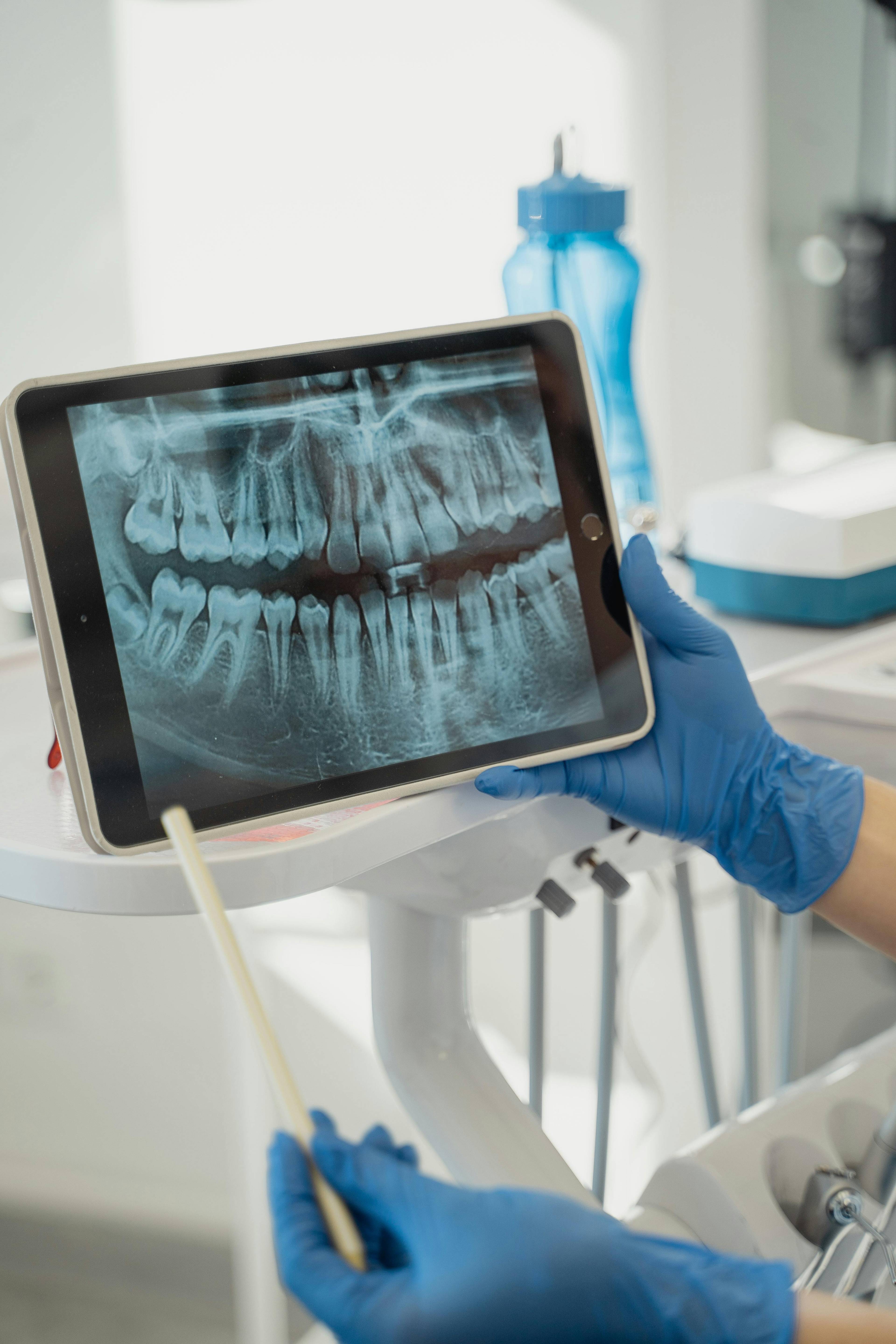 A dentist looking at an x-ray of a patient's teeth on i-pad