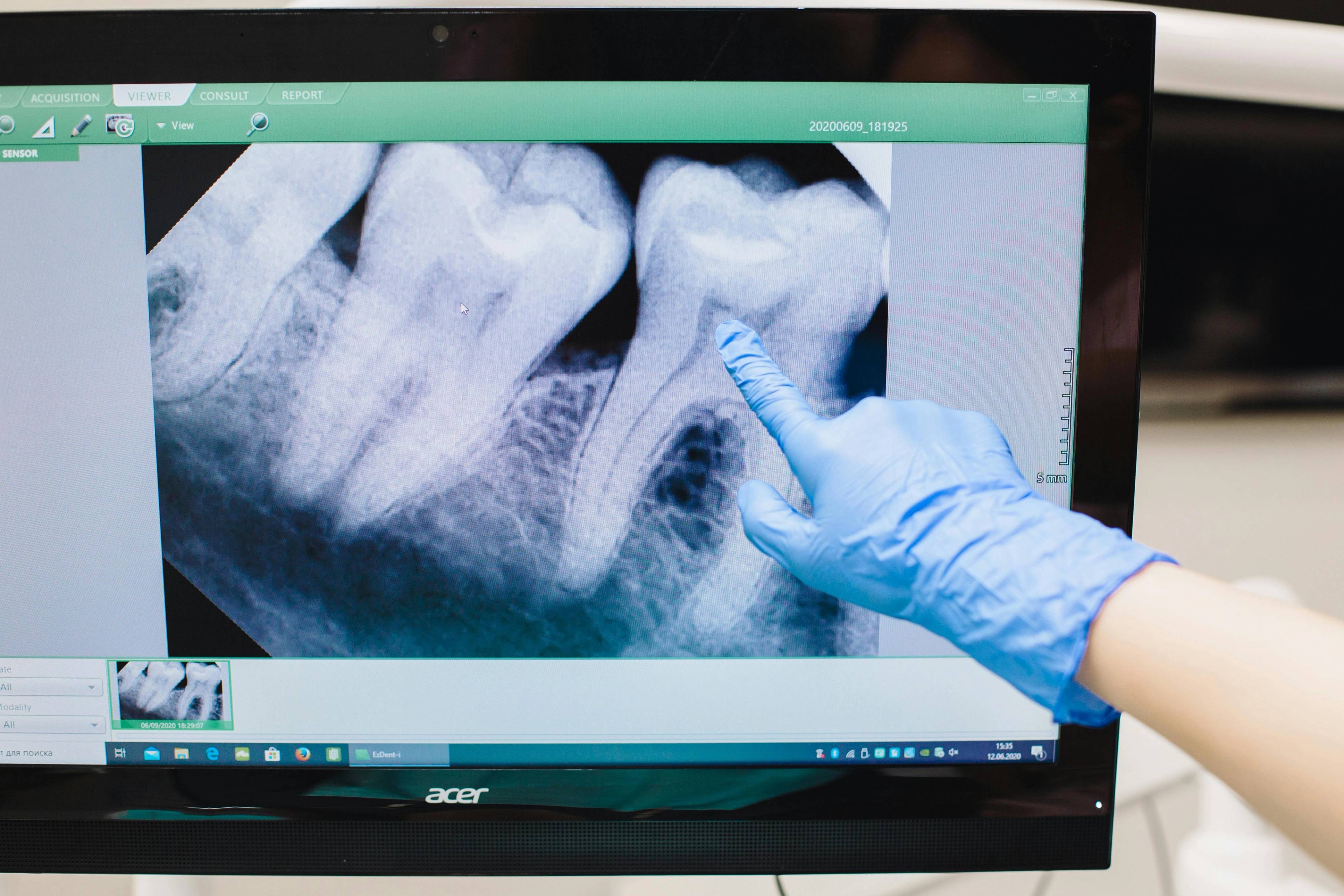 Dentist showing patient an x-ray pointing at the computer screen