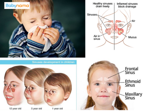 All About Pediatric Sinusitis