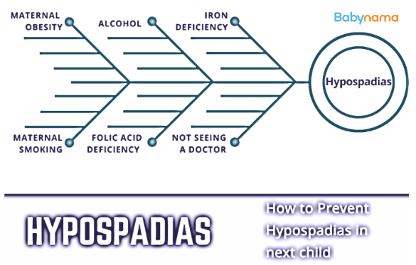 Do’s & Don’t: Hypospadias In Next Children Prevention