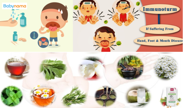 Effective Home Remedies For Hand, Foot, & Mouth Disease (HFMD)