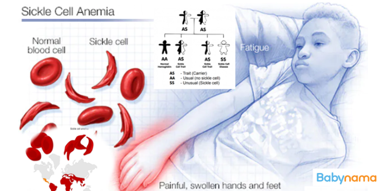 All About Pediatric Sickle Cell