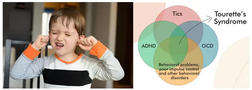 Tourette Syndrome (TS) & Tics