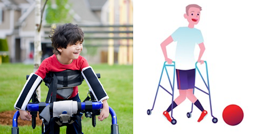  Birth Defects Associated with Cerebral Palsy in Children