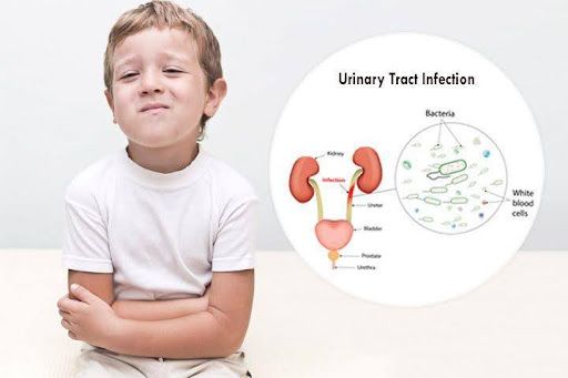 Home Treatment Options for Children's UTIs