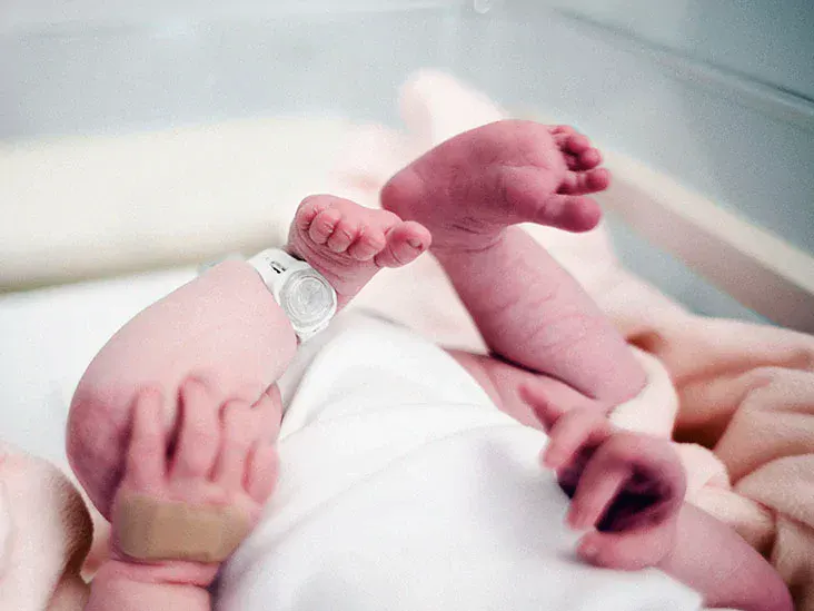 Hypospadias Surgery in Infants