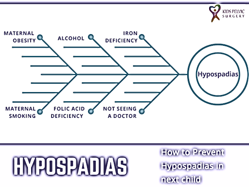 Hypospadias Prevention: Do's and Don'ts for Future Pregnancies