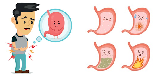 Gastritis in Children: Causes, Symptoms, and Treatment