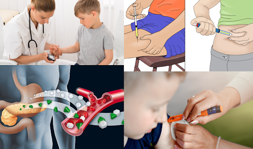 Insulin & Type 1 Diabetes in Children: A Comprehensive Guide