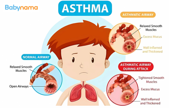 All About Childhood Asthma