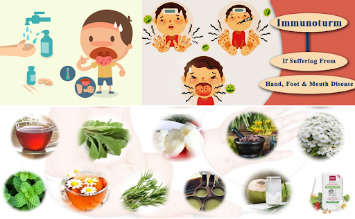 Effective Home Remedies for Hand, Foot, and Mouth Disease (HFMD)