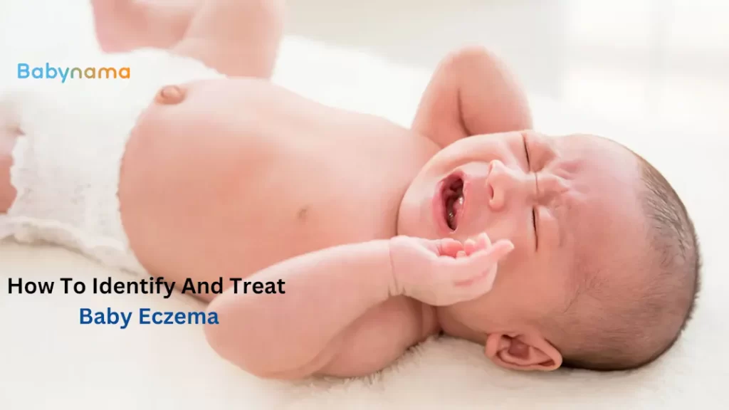 How To Identify And Treat Baby Eczema