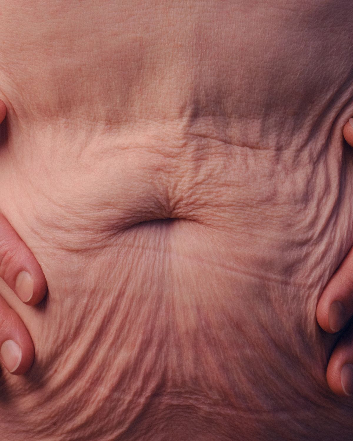 Stomach of a women showing wrinkles and skin texture