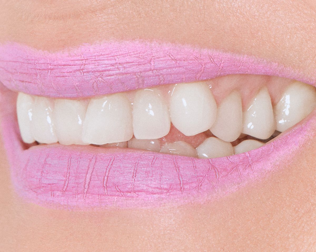 pink lips woonkey teeth cracked