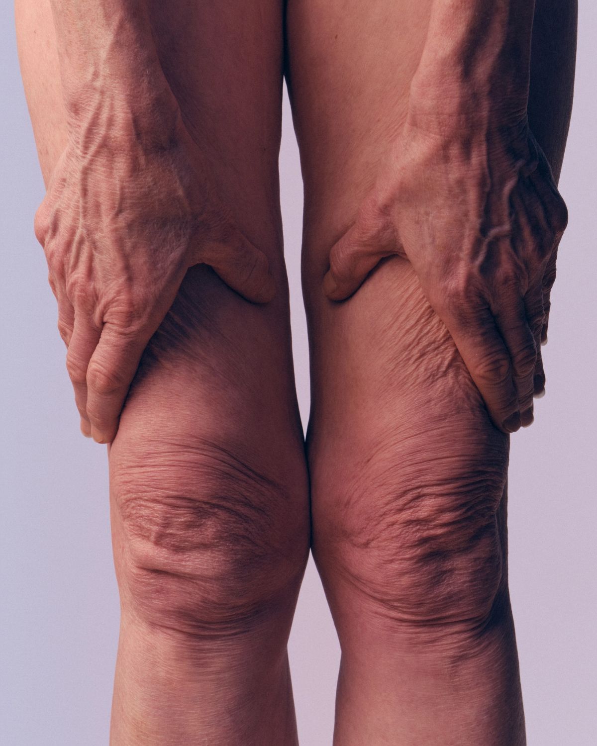 a crop of hands touching knees showing wrinkes on the skin