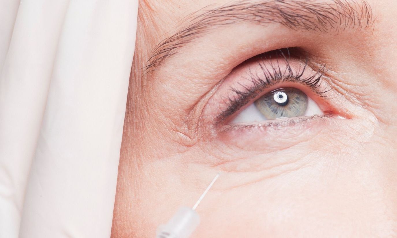 Oczy – dolina łez, zmarszczki