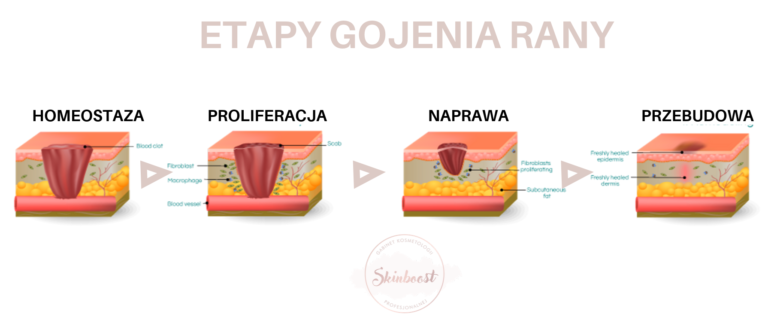Etapy gojenia rany