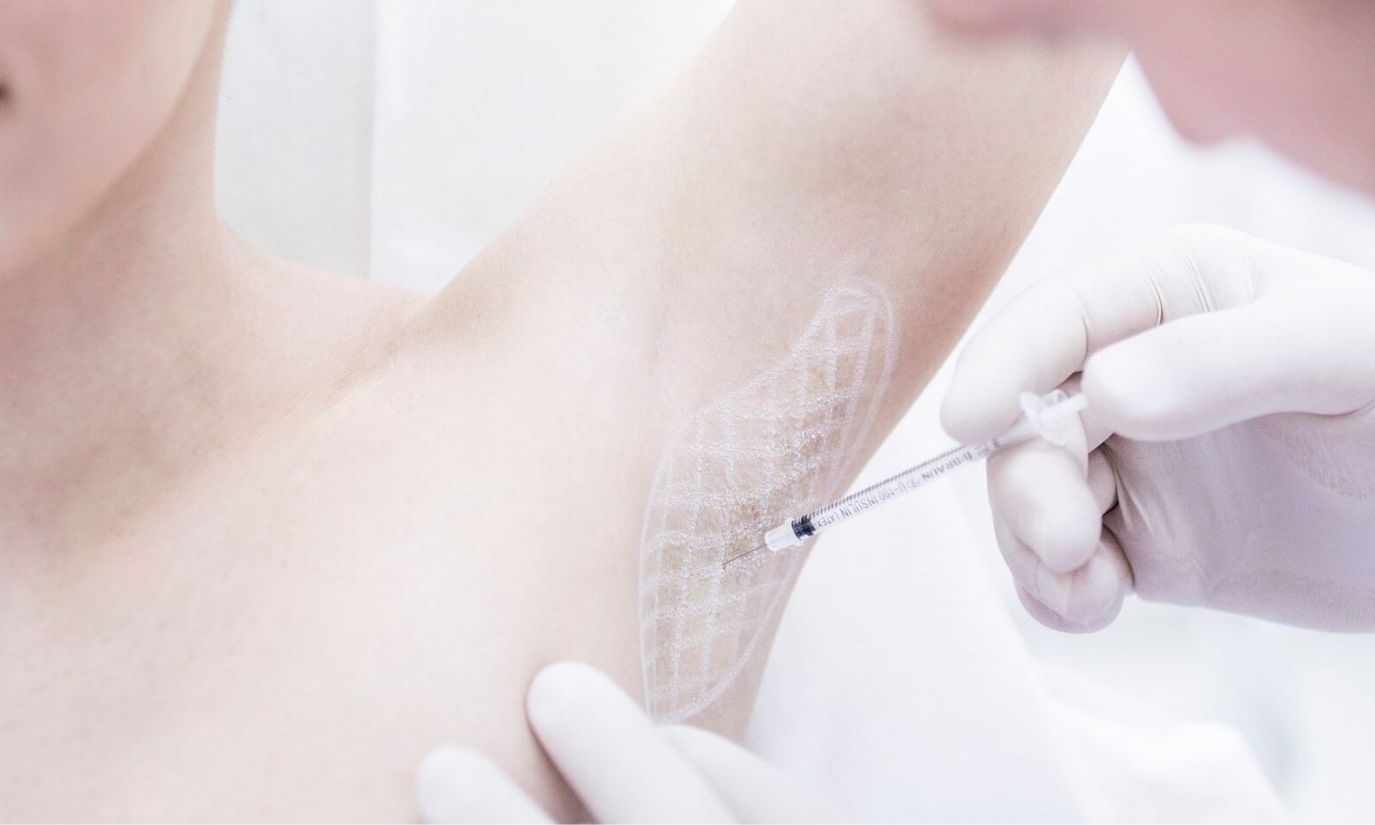 Botox - likwidacja nadpotliwości pach