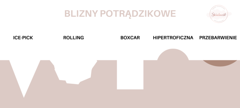 Blizny potrądzikowe
