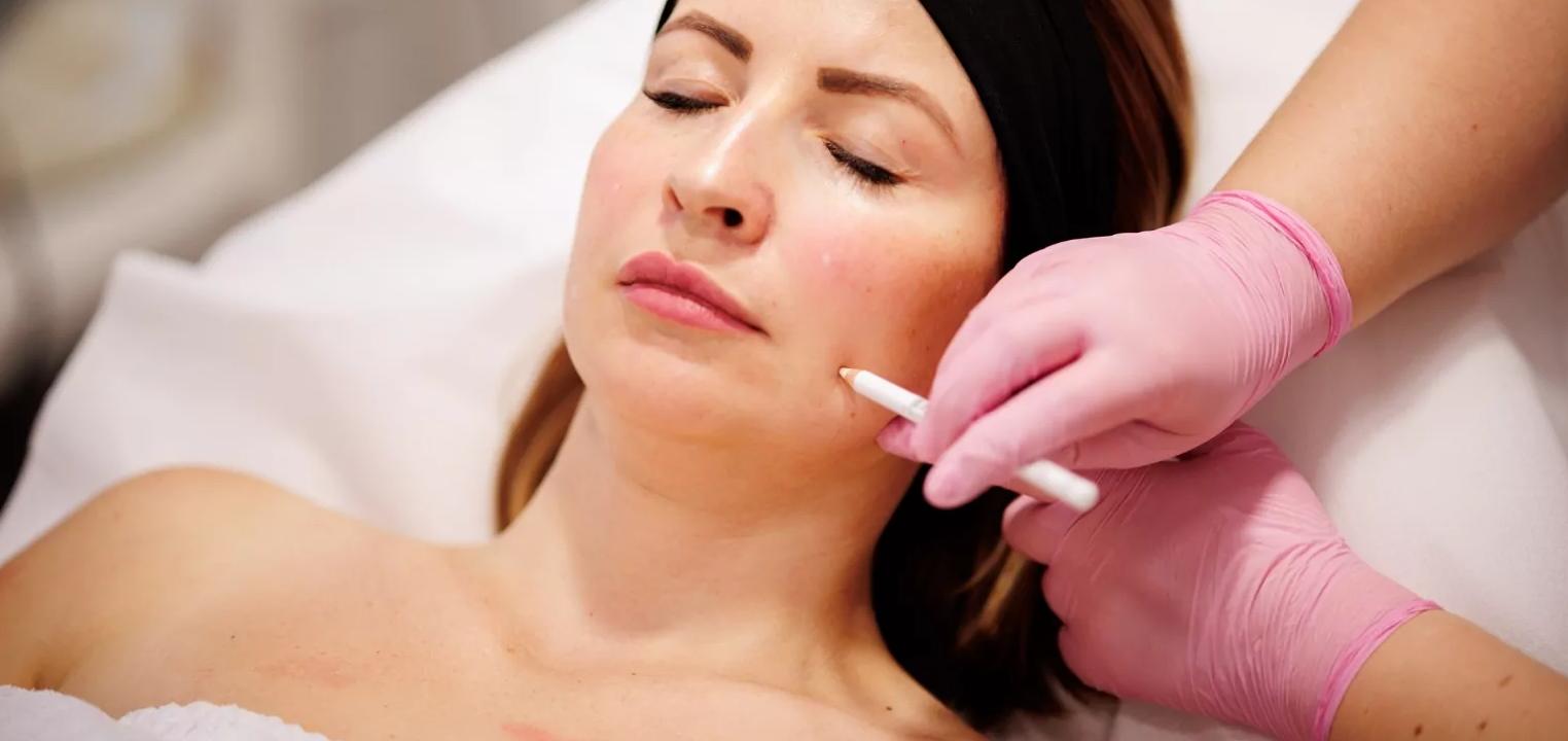 Mezoterapia igłowa