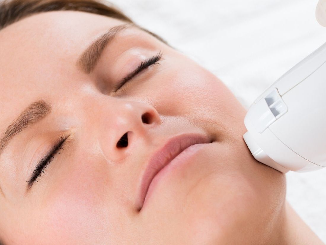 Radiofrekwencja RF Mikroigłowa