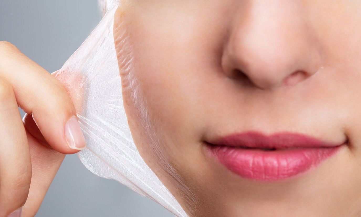 TCA – kwas trójchlorooctowy