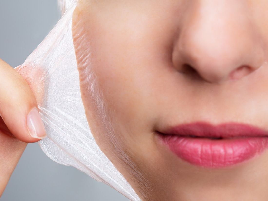 TCA – kwas trójchlorooctowy