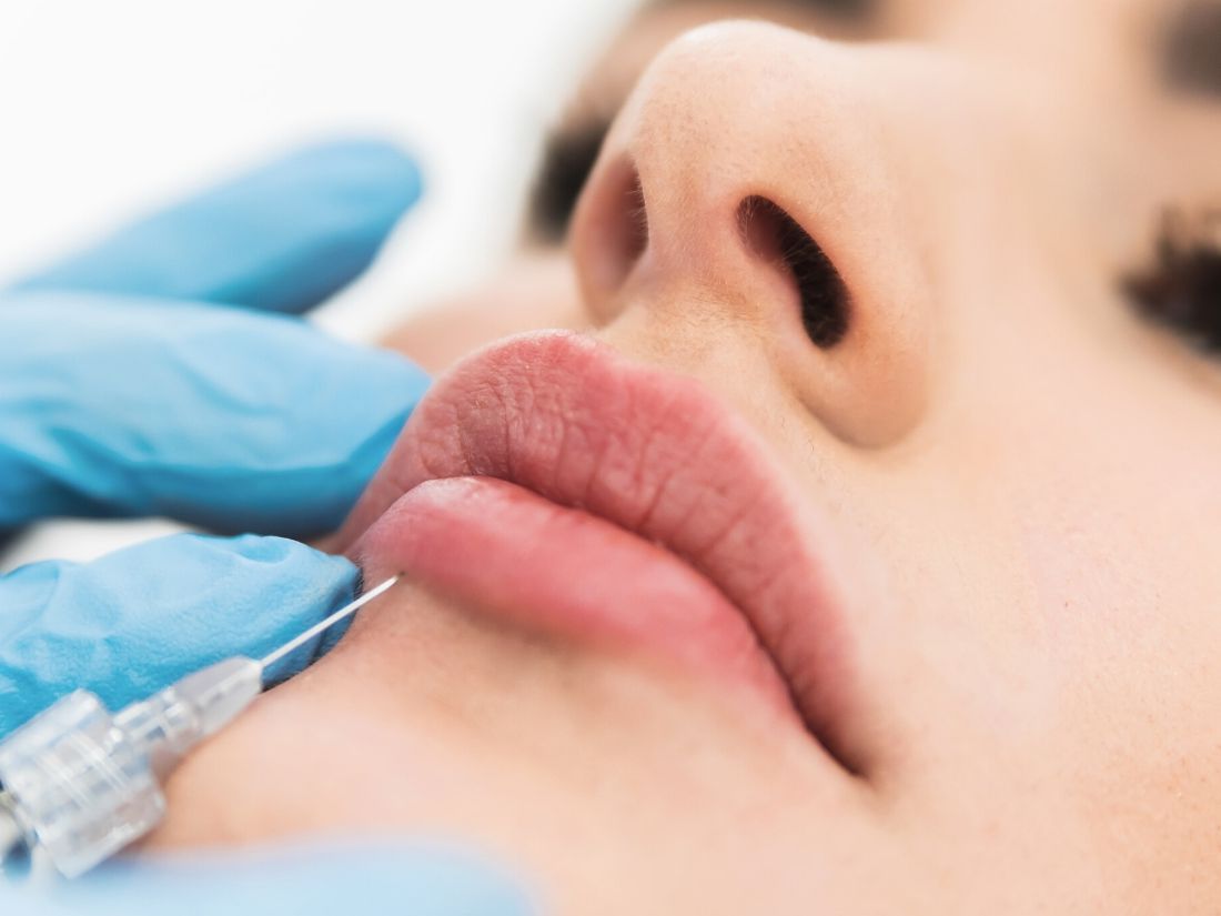 Powiększanie i modelowanie ust