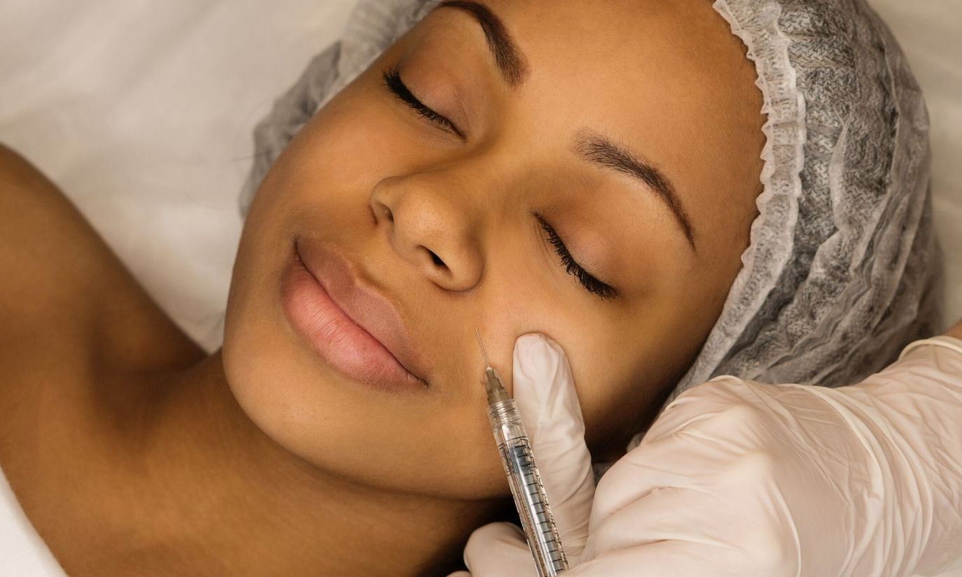 Wypełnianie, usuwanie zmarszczek kwasem hialuronowym